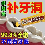 【Repair Tooth Hole】Dental Cavity Repair Repair Dental Cavity Filling Repair Dental Cavity Tooth Repa