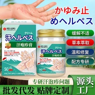 Herpes Cream Hand Foot Peeling Herpes Itching Small Blisters Sweat Herpes Care External Use Cream Re