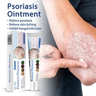 Skin Care Apply Skin Dry Itchy Itchy Skin Prickly Heat Prickly Heat External Use