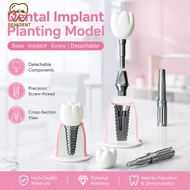 1Pcs Dental Implant Model Training Teeth Teaching Practice Model Detachable Oral Implant Dentist-Pat