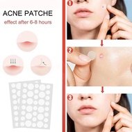 288pcs Invisible Acne Patch – Tea Tree Oil Pimple Removal Stickers for Acne Repair & Scar Treatment