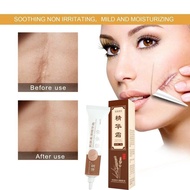 （Original）Effective Scar Removal Cream Scar Gel Old Scars Acne Scars Treatment 20g Skin Repair Acne 