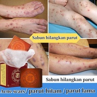 Sabun hilangkan parut Sabun hilangkan parut kudis Sabun parut kaki Hilangkan Bekas luka lama parut h