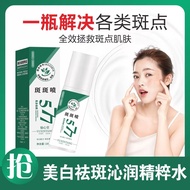National Makeup Special Character 100 Spots Spray 577 Whitening Freckle Removal Spray Essence Whiten