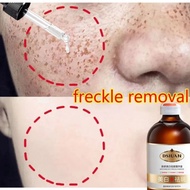 Serum flek hitam Serum flek Serum penghilang flek hitam 100ml Serum bintik ampuh/Serum pemutih binti
