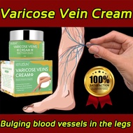 SEFUDUN Varicose veins Promote blood circulation and relieve swelling of veins Varicose veins cream 