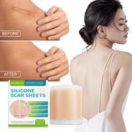 West&Month Silicone scar tape Silicone Scar Sheet keloid scar remover Scar silicone sheet scar patch