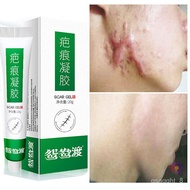 LP-6 SMT🛕QM Herbaceous Acne Surgical Scar Removal Gel Cream Pimples Stretch Marks Spots Burn Surgical Pigmentation Treat