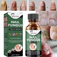Nail Fungus Inhibition Serum Treat Paronychia Infection Soften Thick Nails Stop Fungal Growth Effect
