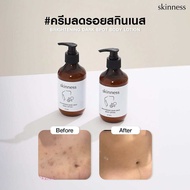 สูตรใหม่! skinness brightening dark spot body lotion ครีมบำรุงผิว