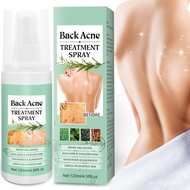 BackAcneTreatmentSprayWithHerbalFormula,2%SalicylicAcid&TeaTreeOil-BodyAcneSolution,120ml ZHGN 1UND