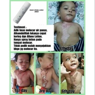 Ramai yg dah tahu kebaikan alano lotion by amway ni....

FIST AID yg perlu kat rumah
Allano Lotion
