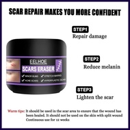 ✥ ✤ ۩ EELHOE Original Scar Repair Cream for old scar stretch mark remover acne scar remover Aliver