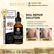 Eelhoe Nail Fungus Treatment 50ml Nail Repair Liquid Nail Growth Repairs