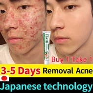 Buy 1 Take 1 Acne Skincare Salicylic Acid Cream Acne Essence Original Body Accutane Acid Anti-Acne C