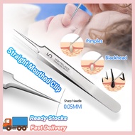 SG Seller Stainless Steel Acne Clip NO.5 Remove Blackhead Tweezers For Nail Art Face Care Eyelash Extension Blemish Pimple Comedo Remove Tools Extractor
