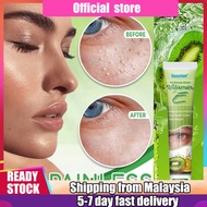 krim milia seed remover vitamin E eye milia cream fat granule syringoma milia remover eye health car