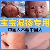 Eczema Baby Dedicated Saliva Eczema Cream Hot Eczema Baby Milk Moss Cream Remove Acne Children's Ded