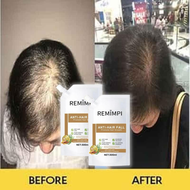 sampo penumbuh rambut REMIMPI Anti rambut rontok Treatment Shampoo Oil Control Anti-dandruff Anti Hair Loss