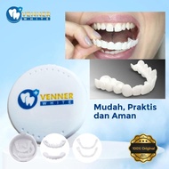 ORIGINAL Snap On Smile Gigi Palsu Venner White Perapih Gigi Instan