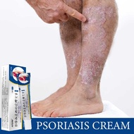 Psoriasis cream eczema ointment anti fungal eczema cream for adult eczema cream 20g