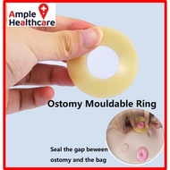 Coloplast Ostomy Moldable Rings 4mm