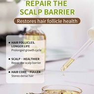 Rosemary Oil For Hair Growth Hair Loss Treatment Hair Tonic Growth Rosemary Oil
