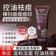 Facial Cleanser (Facial Cleanser) Acne Removal Oil Control Hot Sale In Good Things Recommended~Cean 
