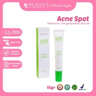 Msglow Acne Spot Treatment / Msglow Acne Spot