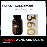 [Halal Supplemen Jerawat] Skynfyx 360 Skin Supplement | Acne, Acne Scars, Hair, Nail Supplement