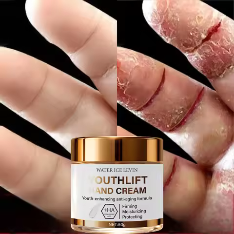 YouthLift Anti-Aging Hand Cream with HA & Retinol for Firming, Moisturizing & Protecting Mature Skin