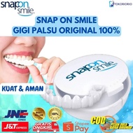 Primadona Snap On Smile Venner Gigi Palsu 1 SET (ATAS &amp; BAWAH) Gigi