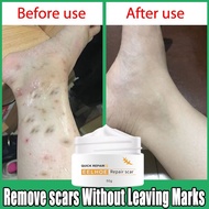 EELHOE Old Scar Remover for Legs 50g Peklat Remover Acne Surgical Stretch Marks Repair Cream Gel