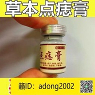 【加瀨下標免運】點痣膏去痣yao水正品無痕祛痣除痣靈祛斑液黑痣去肉痣瘊子去痣膏