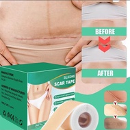 Silicone Scar Sheet Acne Scar Patch Hilangkan Parut Jerawat Keloid Scar Removal Parut Kaki Skin Repa