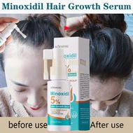 5% Minoxidil Hair Growth Spray Fast Hair Growth Spray Anti-Hair Loss Hair Care 30ml For Man And Woma
