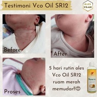 Promo Vco Virgin Coconut Oil / Vico Oil Sr12 / Minyak Kelapa Murni /