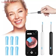 [LoyaltyDuck] Wireless Ear Wax Cleaner With Camera Safe Earwax Removal Endoscope With Camera Luminou