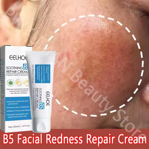 40ml B5 Facial Repair Cream Soothes Redness Improve Sensitive Skin Itching Improve Sunburn Skin Nour