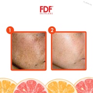 hj_store.my Fdf Skincare  Lightening  Rejuvenating  Essence 22gm With Free Product Sample