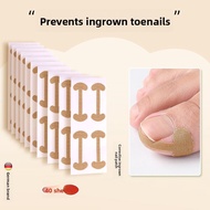 CMGF | Ingrown Toenail Correction Pad