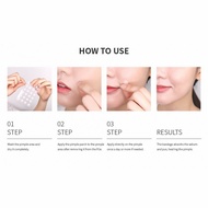 Cosrx acne pimple master patch