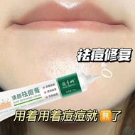 Official acne removal cream to remove acne oil to reduce acne acne removal官方祛痘膏祛痘控油淡化痘痘粉刺祛青春痘学生男女祛痘官