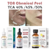 50% TCA Chemical Peel Serum Skin Peeling Acid 7-15 Day Delivered Skin Superforce Peeling Pigmentatio