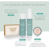 Acne Series - Acne Balm X-Ne Spray Scar Toner Golden Herb Soap Sendayu Tinggi