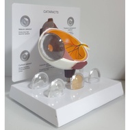 Eye Model Ophthalmological Anatomy