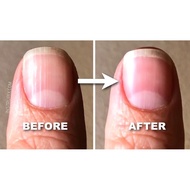 CND rescue RXx 3.7ml/ can use for 40 times