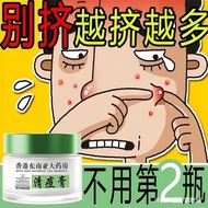 【香港大药房】祛痘膏青春痘熬夜上火痘姨妈痘痘印痘坑男女6.25