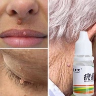 SKIN TAG REMOVER mole remover corn remover wart remover penanggal ketuat kutil tahi lalat bintik hit