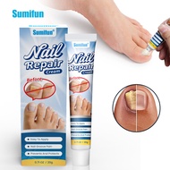 Sumifun Onychomycosis Cream Russia WBcoupang Shopee K10188